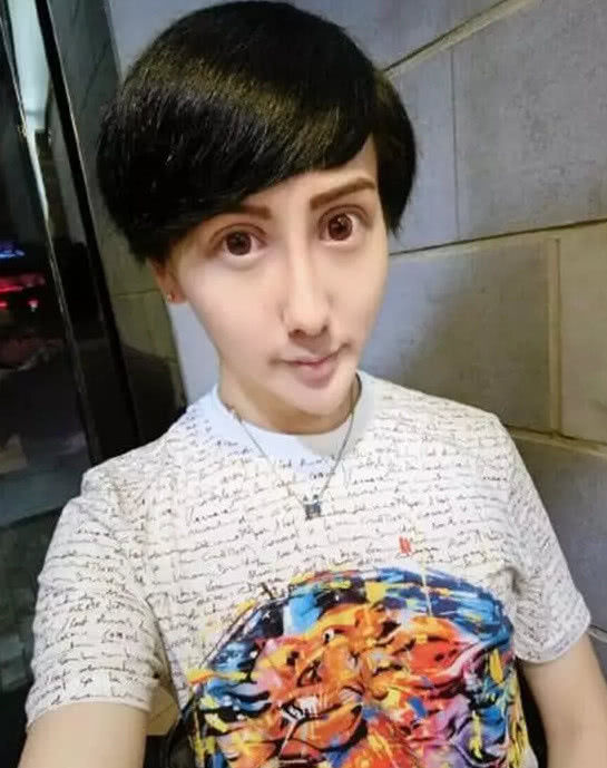 全球五大整容狂人,万万没想到第一名竟是中国人!