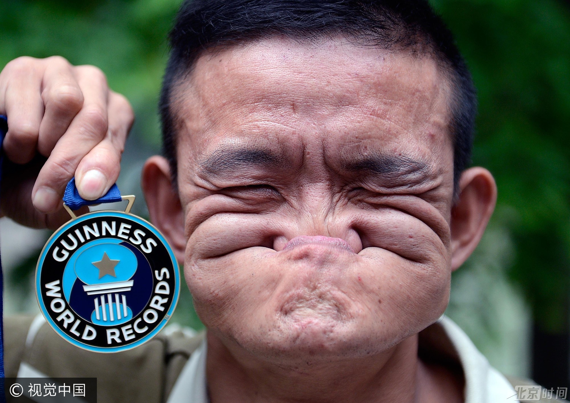 2012年，四川省成都市，“烂脸王”汤术全表演嘴巴吃鼻子，并展示在意大利参加吉尼斯世界纪录表演秀获得的奖牌。