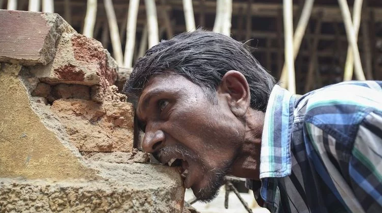 男子喜欢吃砖泥,每天吃3斤,去医院后他的身体让医生都感到奇怪