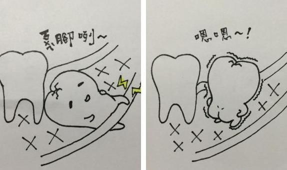 拔智齿之后为什么不让吐口水