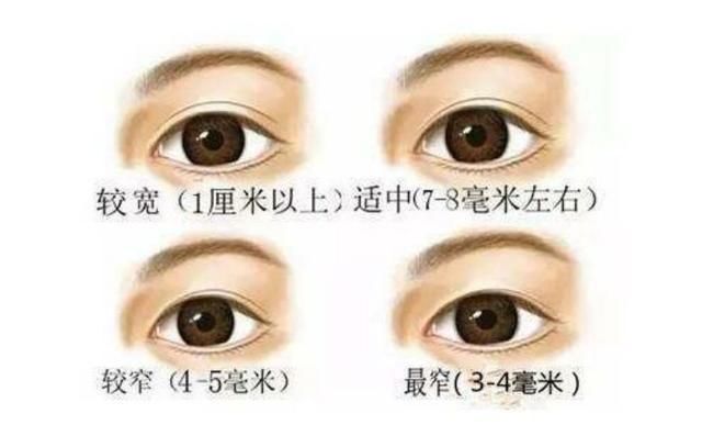 别贪恋欧式大平行双眼皮了!7mm小平行更适合