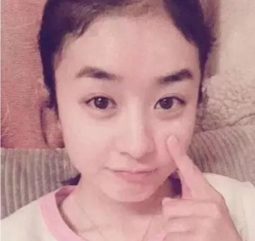 杨幂在植发,赵丽颖却后撤发际线1cm?