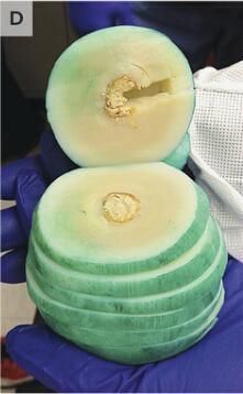 男子上厕所时感到下体异常疼痛,腹部内的物体