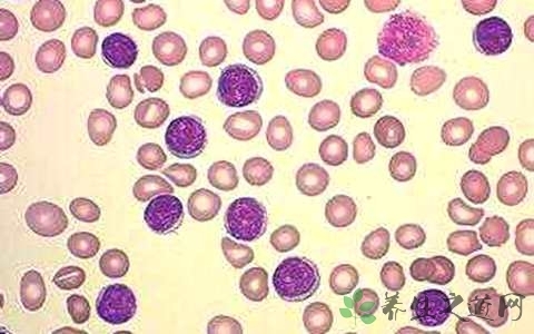 老年人白细胞高是什么原因