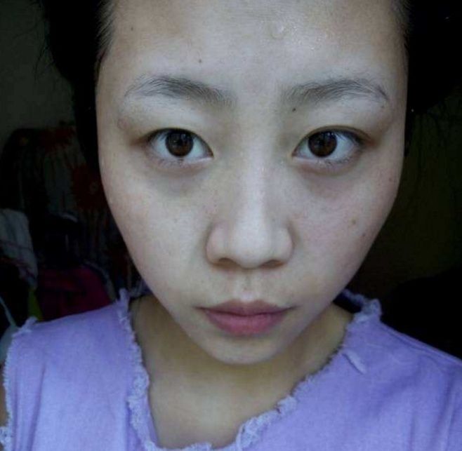 牙膏加入淘米水竟然也可以祛斑,找到方法祛斑