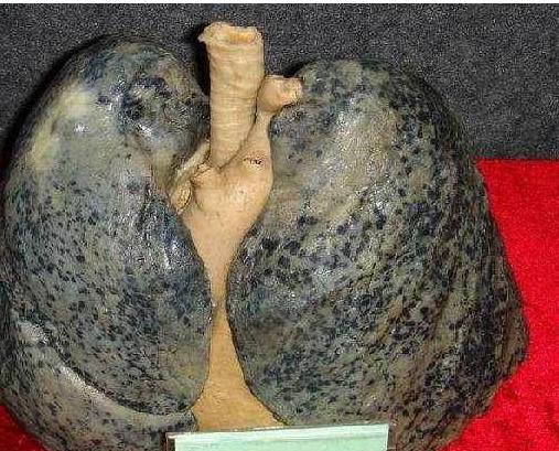 危害健康已是众所周知的事实 。那突然戒烟对