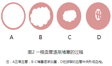 细数普洱茶的十大保健功效