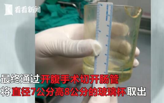杯具!男子肛门塞进直径7厘米玻璃杯 医生开腹取出 杯具!男子肛门塞进直径7厘米玻璃杯 医生开腹取出