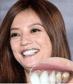 娱乐圈做过烤瓷牙的明星,赵薇的牙都能反光,刘