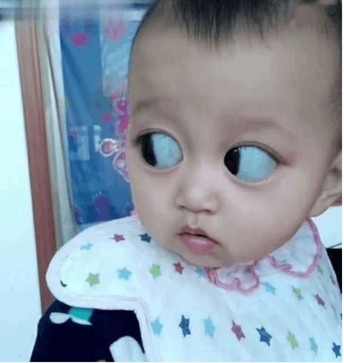 广东一女子怀孕期间天天吃黑葡萄, 结果孩子出