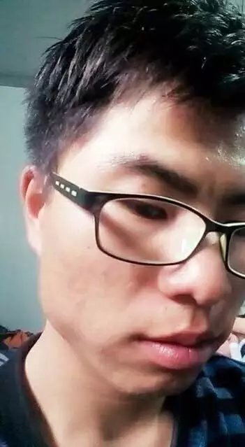 男生脸上长痘痘是什么原因?满脸痘痘该如何让