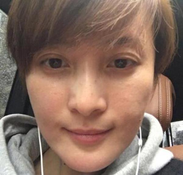 脸部过敏已好转!给你们看看蒋勤勤素颜照片