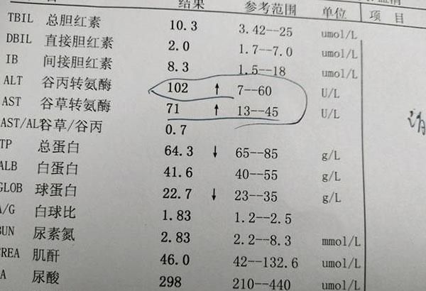 谷丙轉氨酶偏高怎麼降下來_丙谷轉氨酶高和丙草_孕婦丙谷轉氨酶偏高