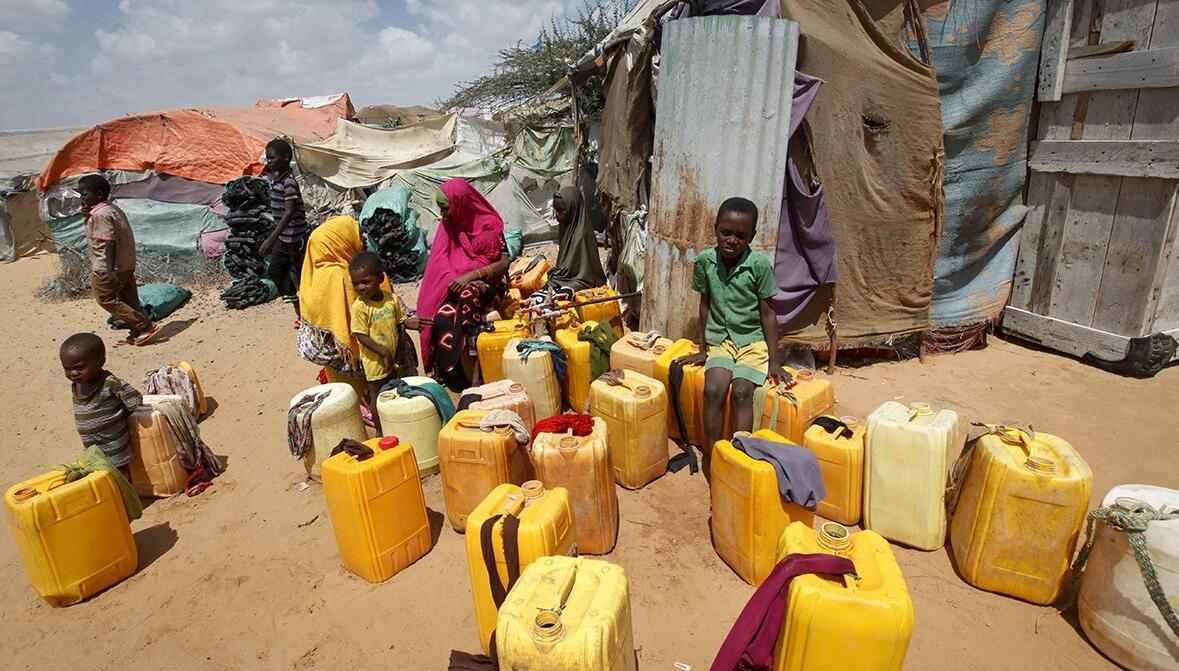 索马里持续干旱引发饥荒 儿童瘦脱形