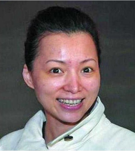 林志玲喝酒过敏,周迅抽烟爆痘痘,明星卸了妆,皮