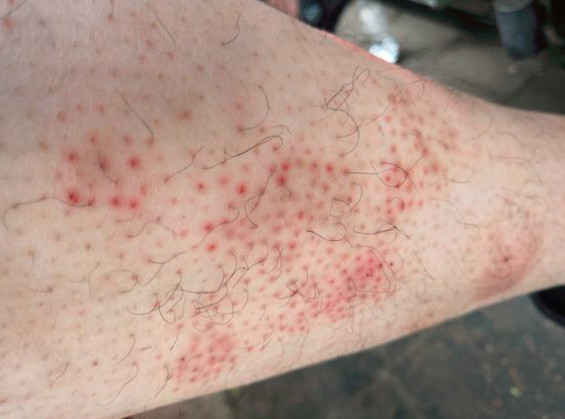 鸡皮肤用什么身体乳更好呢?这个牌子用过的都