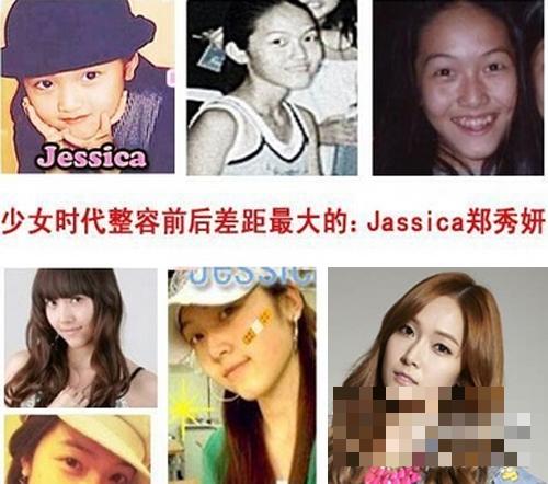 少女时代成员整容前后对比 郑秀妍允儿旧照吓人