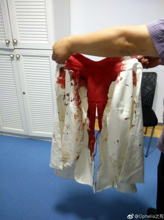 遇袭女游客外套被鲜血染红(图片源自当事人微博)
