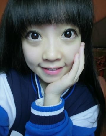 冯提莫整容被翻出,脸部两侧肥肉纵横,鼻子又大