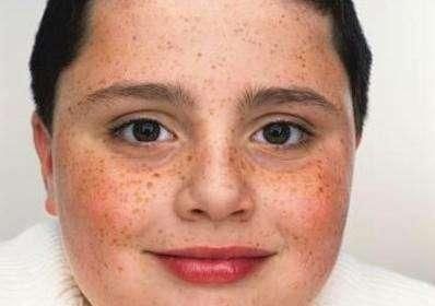 最接地气的祛斑方法:睡前土豆敷脸,直达基底层