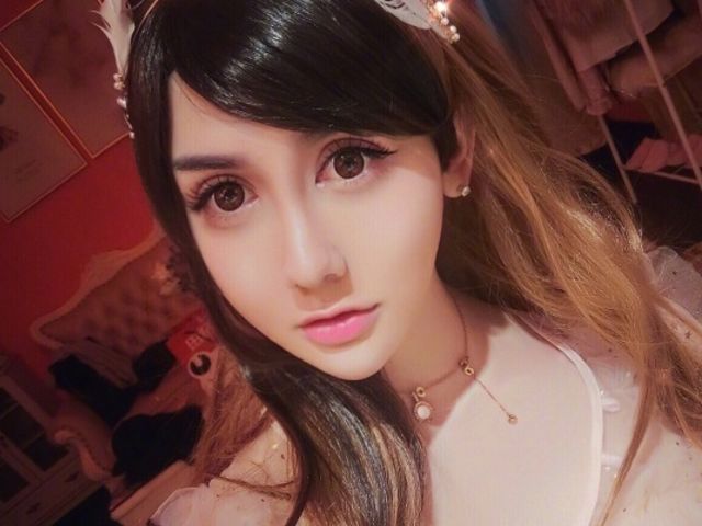 "蛇精男"刘梓晨融掉脸上玻尿酸,回归真实状态,网友直呼认不出