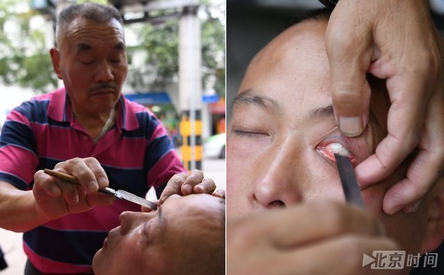 六旬老人用刀片给人洗眼睛 称40年没出过差错 六旬老人用刀片给人洗眼睛 称40年没出过差错