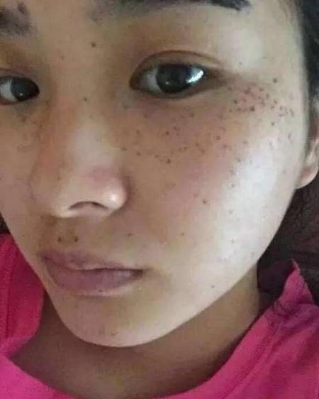 小姨无意间用蜂蜜掺"它"抹脸,斑点皱纹来不及说再见,皮肤白皙