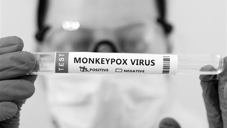 重庆发现1例境外输入猴痘病例，科普：猴痘如何传播？怎么预防？