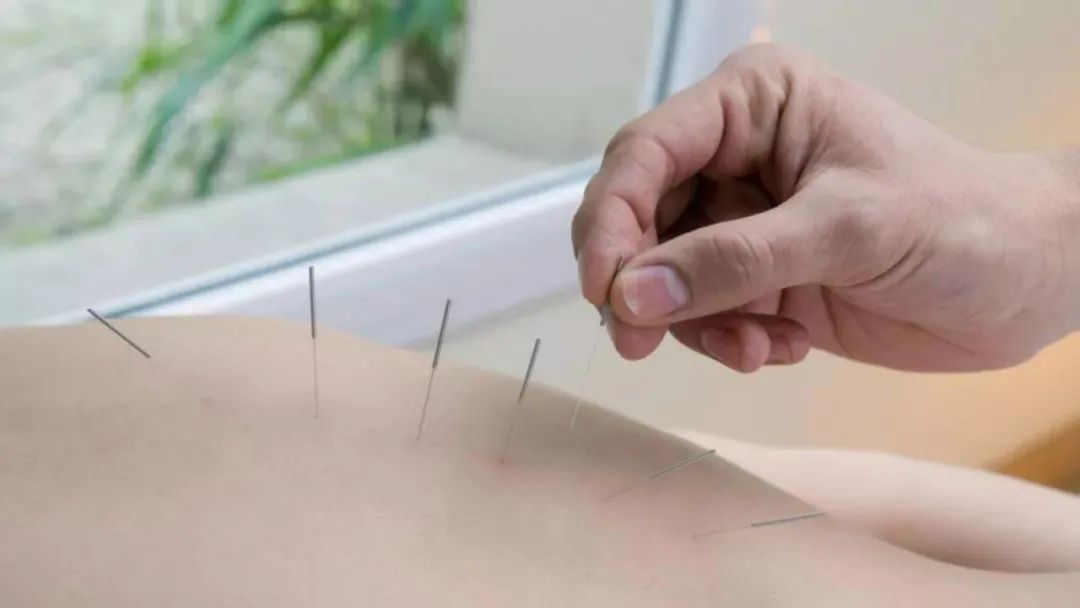 腿疼为什么还是无法治愈?贴膏药,扎针灸,换关节