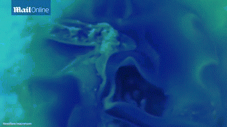 相信每个人都吃过药，但你有没有想象过药片在你的胃里面融解的样子？