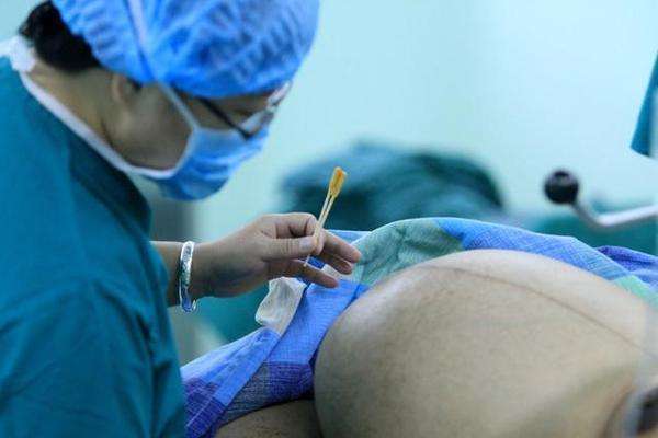 老公深夜做梦竟踹了怀孕妻子的肚子,医生说的