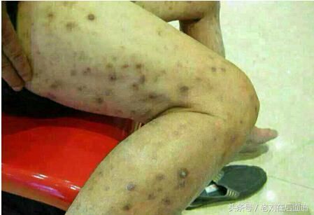 男子梦见白马断腿,自己双腿生疮而死