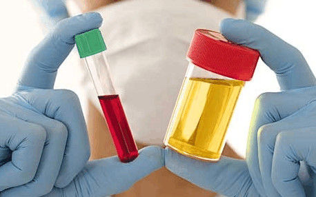 尿酸高的凶手竟然是它!尿酸高吃什么食物比较