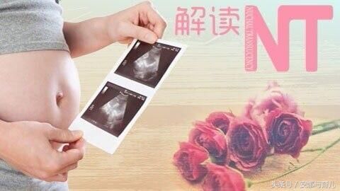 孕妈妈产前所做的NT检查是什么?孕妇为什么要