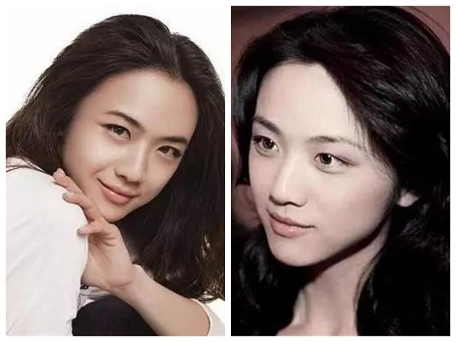 内双和单眼皮的区别就在于眼部脂肪的厚度,这取决于你有没有生成那一