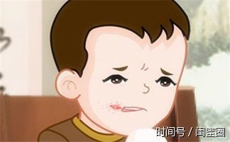 儿童冬季高发病如何防治? 北京天使儿童医院