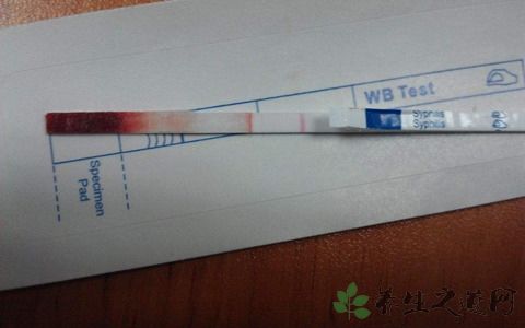 梅毒自测试纸怎么用