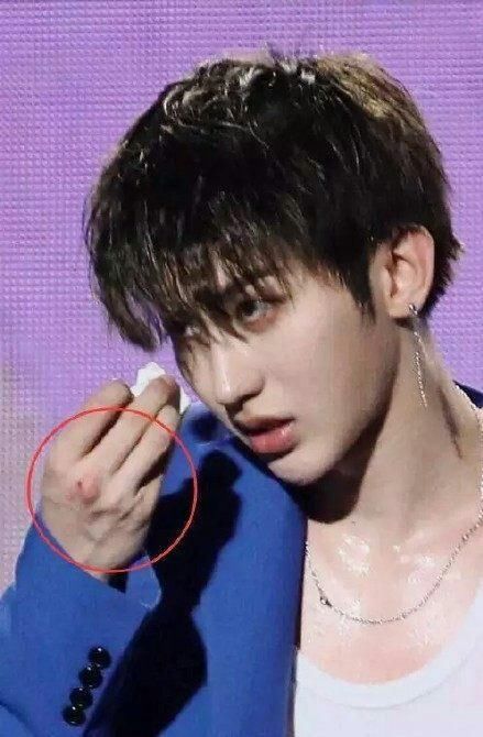 百分九男团巡演蔡徐坤遭黑粉激光照射眼睛,生