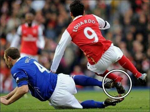 拉莫斯断臂萨拉赫算什么?盘点足坛最令人发