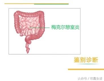 肚子疼,恶心呕吐还发烧,家长警惕孩子是阑尾炎