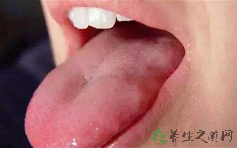 治疗胃寒的中药方剂