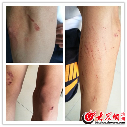 大学生情侣校园搂抱被查遭围殴 涉事学生被处分 大学生情侣校园搂抱被查遭围殴 涉事学生被处分