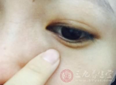 左眼皮一直跳是怎么回事 预示着身体的疾病