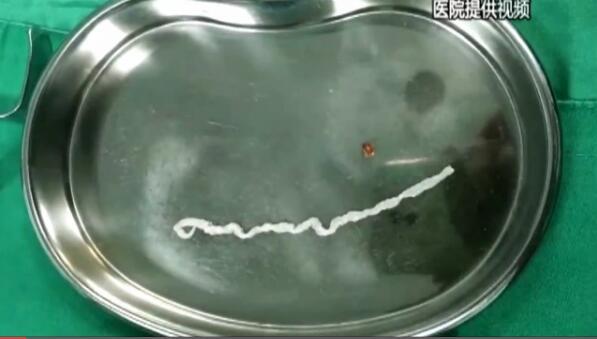 女子爱吃野味乳房凸起包块 里面有条20公分长