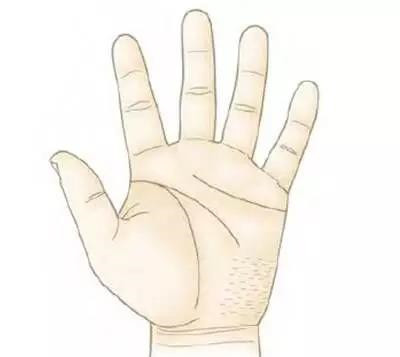 经常喝酒的人可以多注意观察以下3个部位: 手掌 当患了酒精肝,慢性