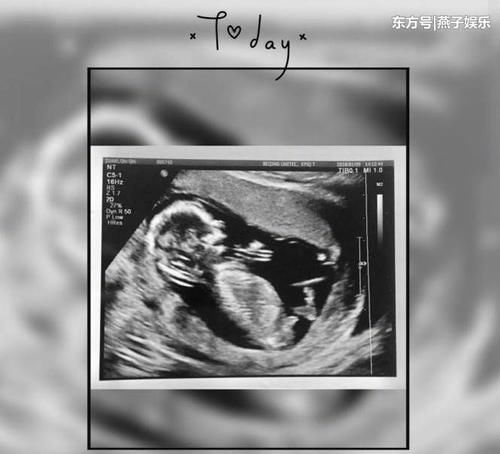 陈建斌产房门外焦急等待,蒋勤勤二胎预产期推