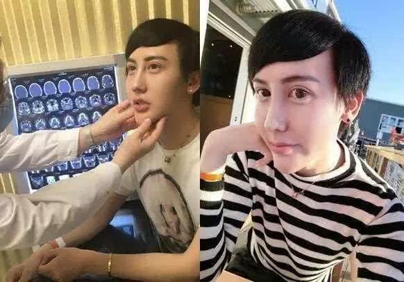 韩国整容脸VS国人整容脸,一个自然一个蛇精脸