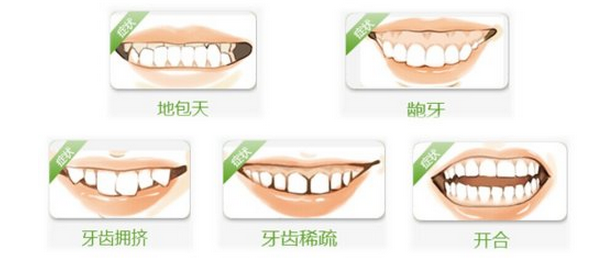 杭州牙齿矫正口腔医院 牙齿矫正 不让孩子输在