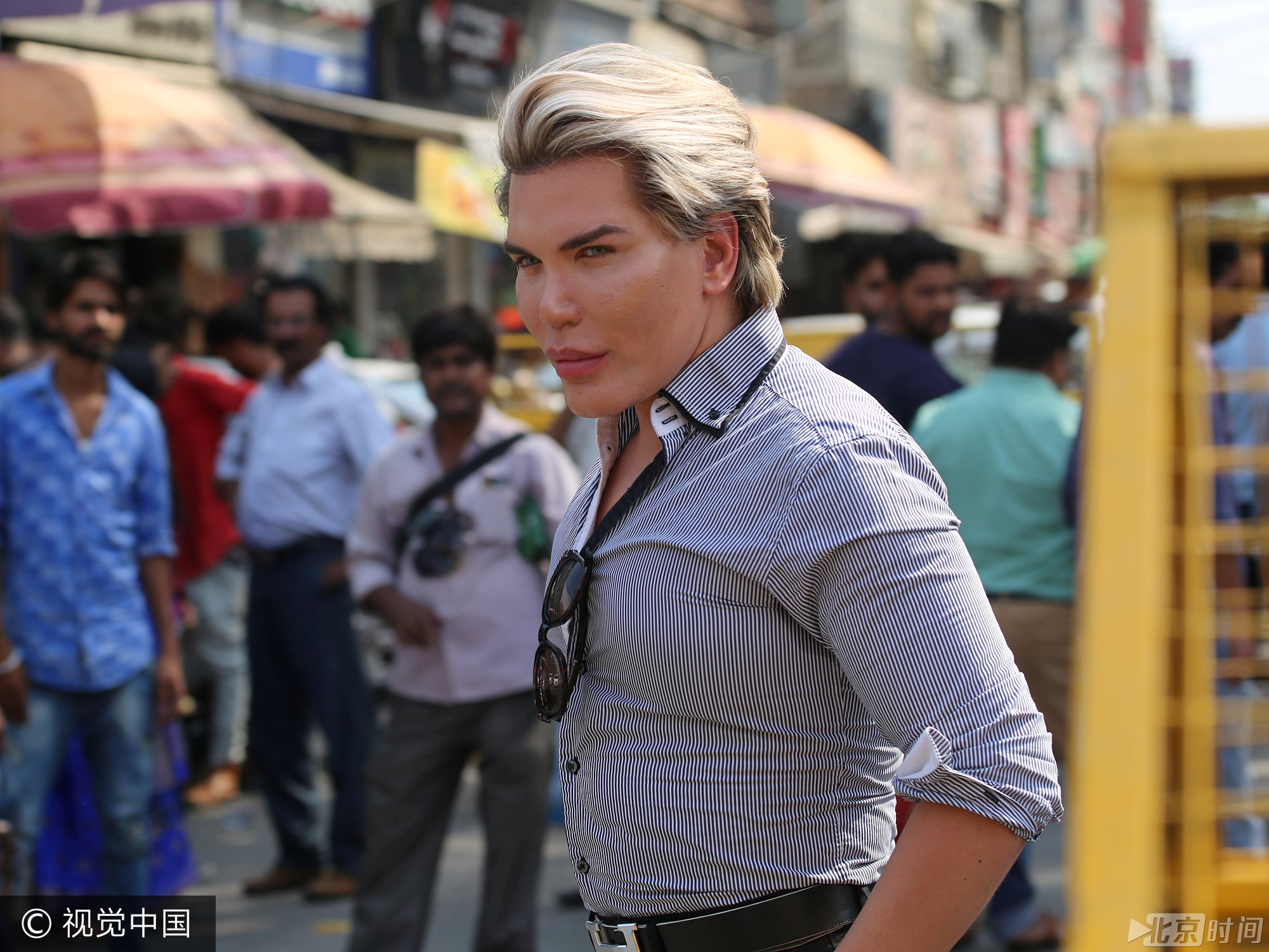 他身上的整容部位多达150处。