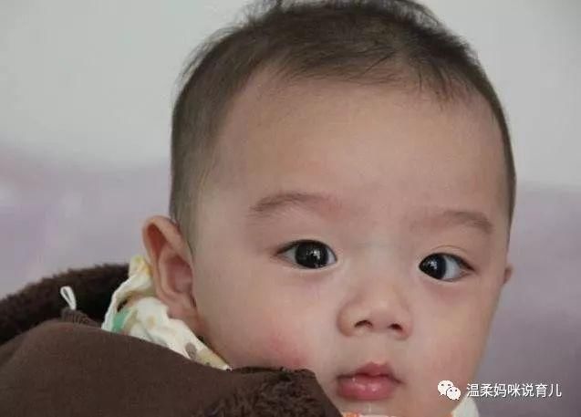 为什么宝宝一生病,单眼皮就会变双眼皮?你家宝